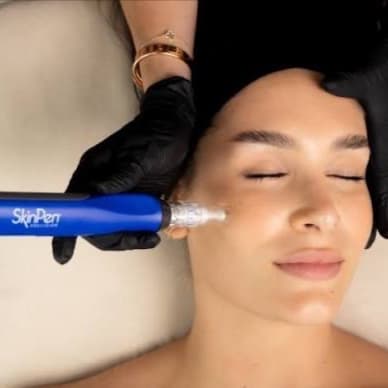 SkinPen Microneedling at The Skin Concierge in Northbrook, IL
