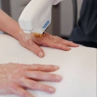 BBL Hands-3 pack at The Skin Concierge in Northbrook, IL